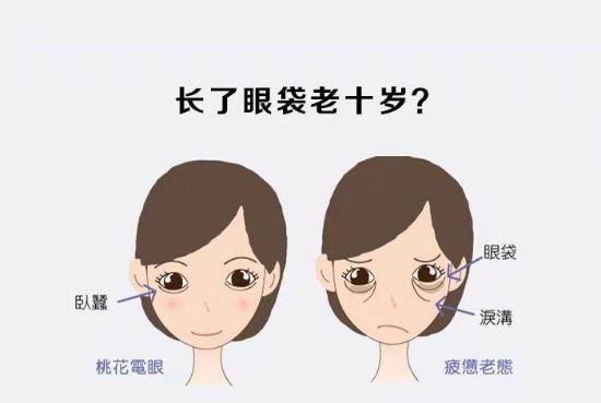 怎么去眼袋？医美专家分享最佳护理方案！